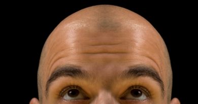 Novas pesquisas sobre queda de cabelo: existe cura para a calvície?